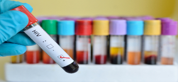 Online live CEUs for respiratory therapists:Everything You Need to Know About HIV AIDS